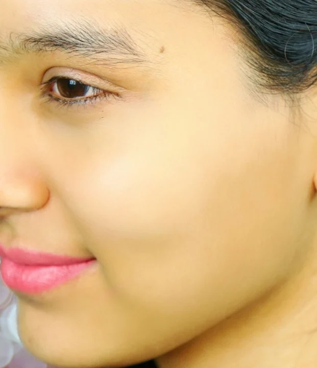 After treatment — Full Face