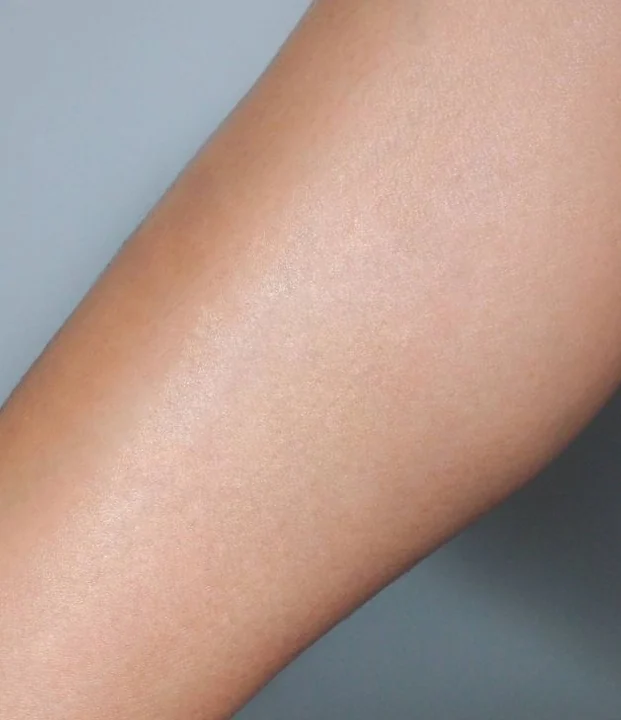 After treatment — Full Legs